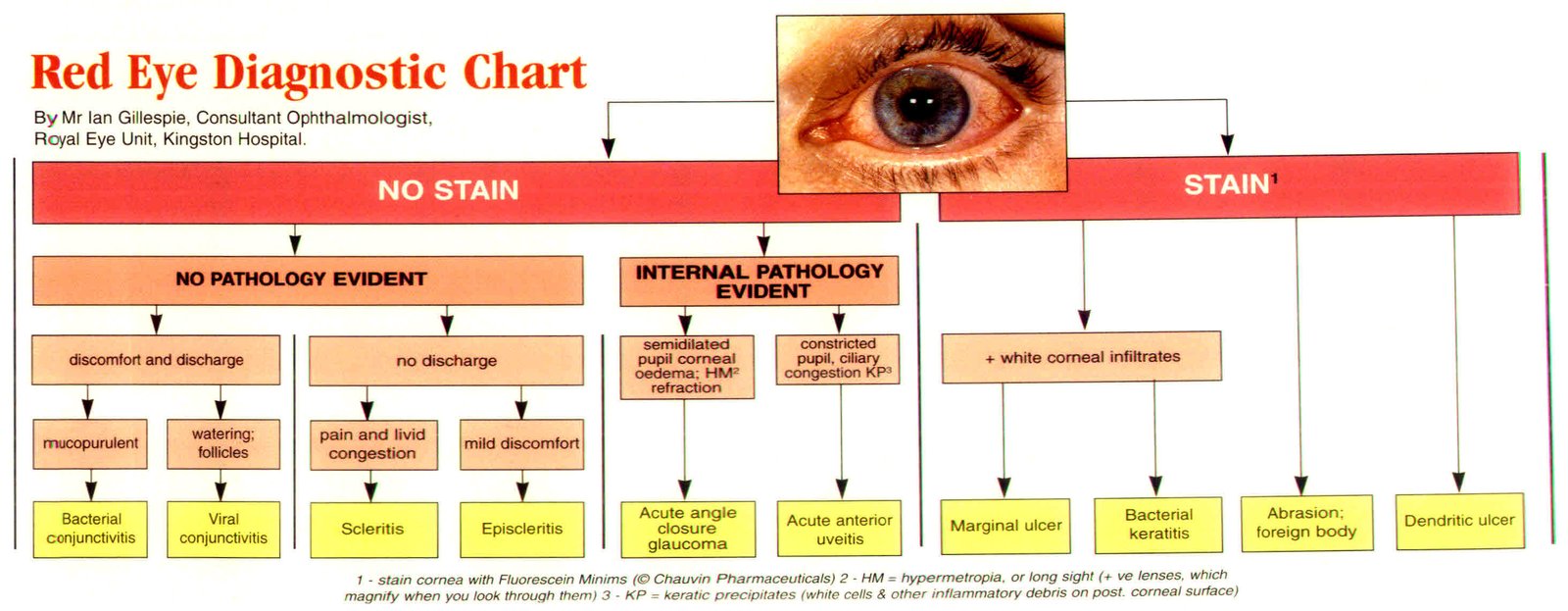 Red Eye Diagnosis Chart